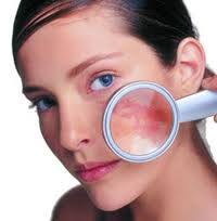 tratamiento de manchas en clinica de dermatologia en madrid